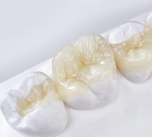 Микропротезирование зубов керамическими вкладками в стоматологической клинике Литфонда